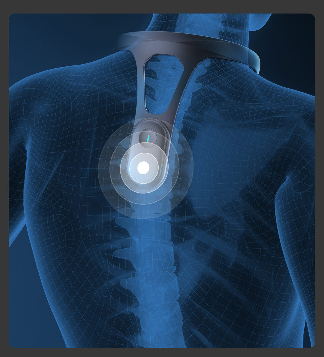 Alignory™ Cue – Smart Posture Corrector